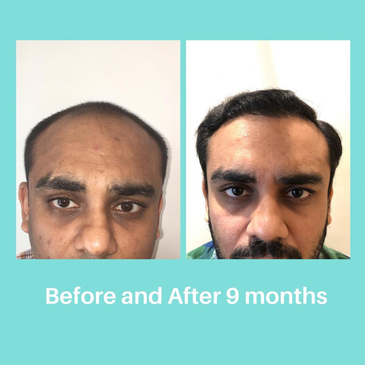 Slider image (7) Zeeva Skin & Hair Clinic